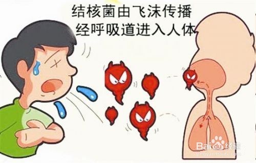 如何預(yù)防肺結(jié)核？